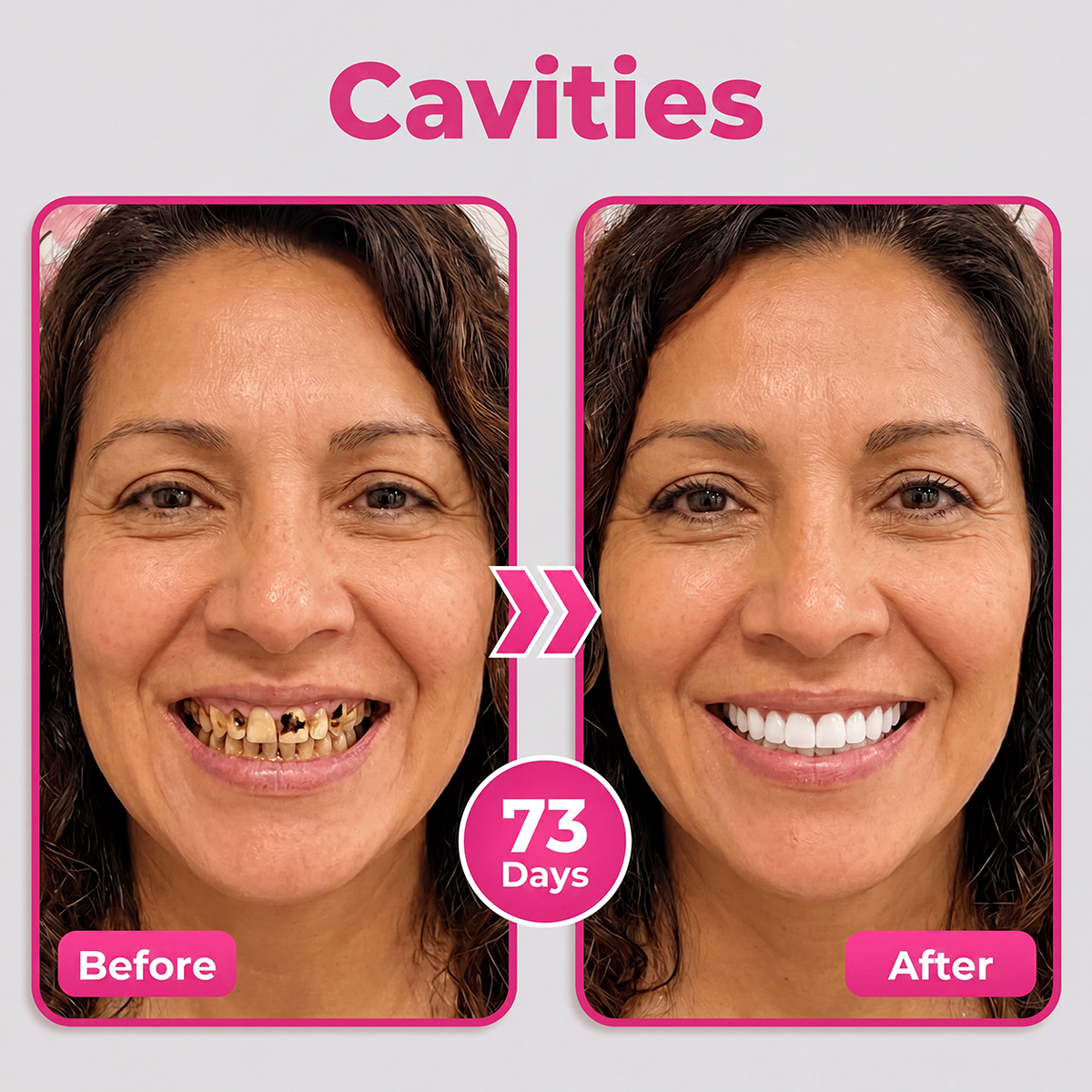 𝐃𝐫.𝐄𝐫𝐚® Thismile NH-10 Enamel & Gum Advanced Therapy Toothpaste Serum