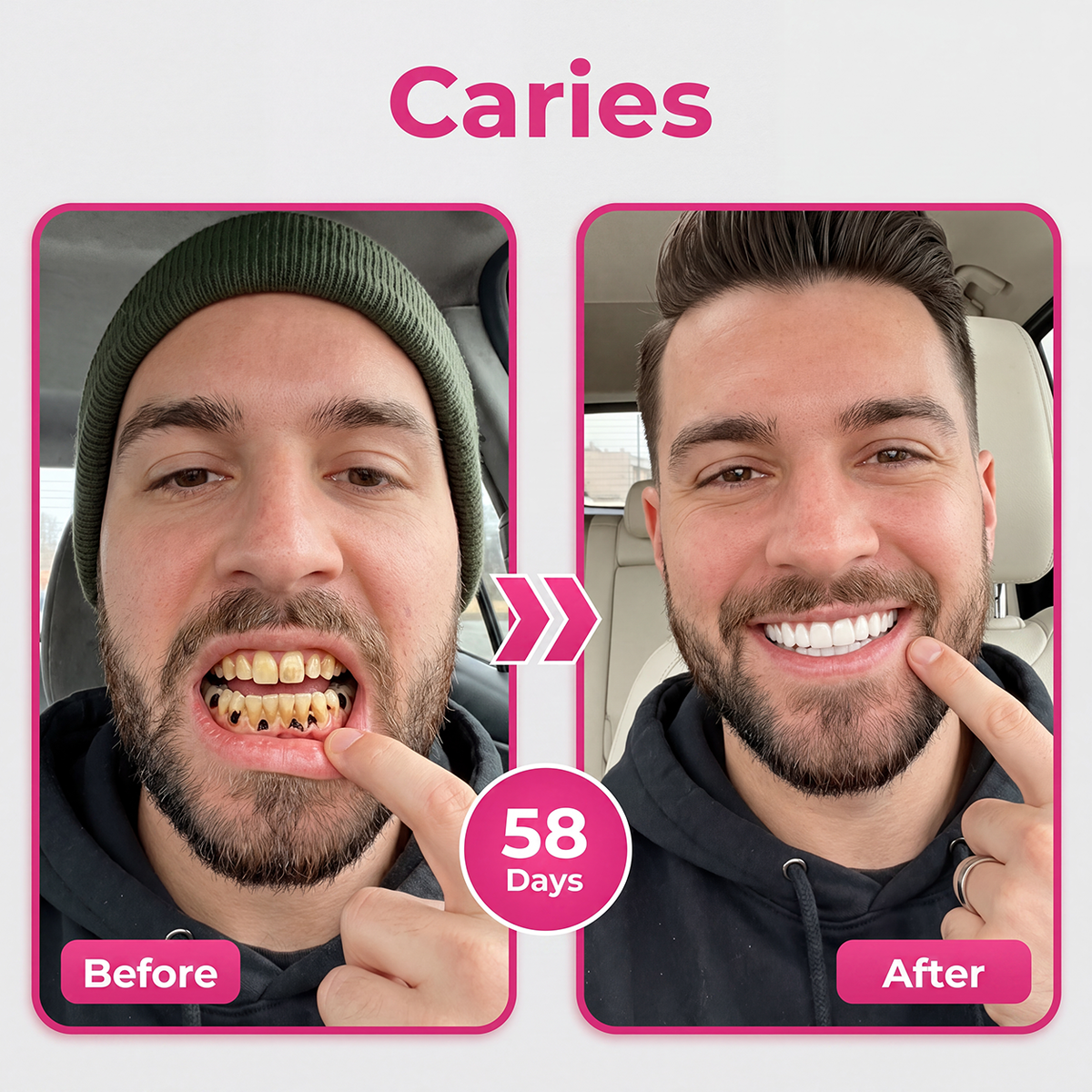 𝐃𝐫.𝐄𝐫𝐚® Thismile NH-10 Enamel & Gum Advanced Therapy Toothpaste Serum