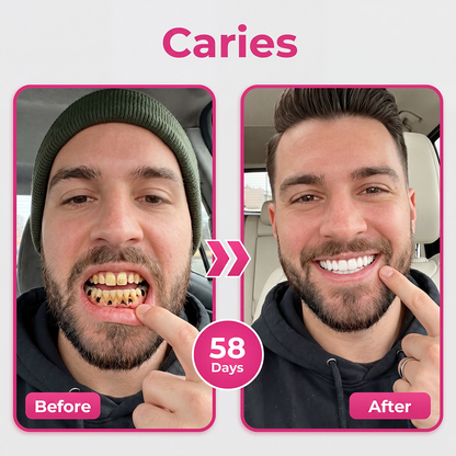 𝐃𝐫.𝐄𝐫𝐚® Thismile NH-10 Enamel & Gum Advanced Therapy Toothpaste Serum
