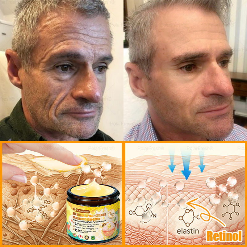 🎁 Shipped from CA | Clinically Proven: PolarFresh® Bee Venom Wrinkle-Firming Multi-purpose Cream with bee venom peptides, botulinum toxin, hyaluronic acid, and collagen💧. Targets wrinkles, fine lines, sagging, stretch marks, dark spots and more (Copy)
