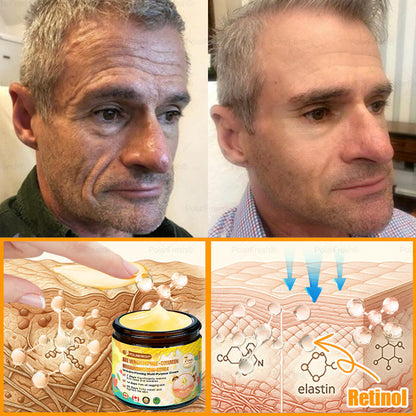 🎁 Shipped from CA | Clinically Proven: PolarFresh® Bee Venom Wrinkle-Firming Multi-purpose Cream with bee venom peptides, botulinum toxin, hyaluronic acid, and collagen💧. Targets wrinkles, fine lines, sagging, stretch marks, dark spots and more (Copy)