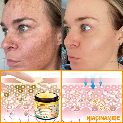 🎁 Shipped from CA | Clinically Proven: PolarFresh® Bee Venom Wrinkle-Firming Multi-purpose Cream with bee venom peptides, botulinum toxin, hyaluronic acid, and collagen💧. Targets wrinkles, fine lines, sagging, stretch marks, dark spots and more (Copy)