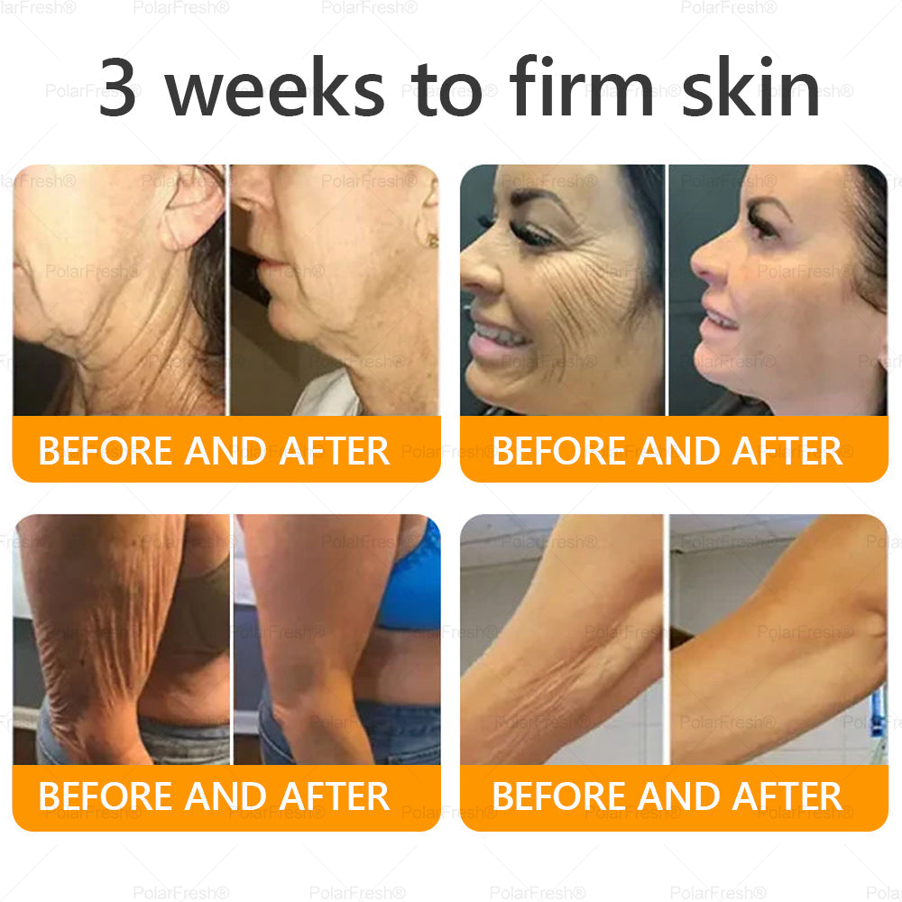 🎁 Shipped from CA | Clinically Proven: PolarFresh® Bee Venom Wrinkle-Firming Multi-purpose Cream with bee venom peptides, botulinum toxin, hyaluronic acid, and collagen💧. Targets wrinkles, fine lines, sagging, stretch marks, dark spots and more (Copy)